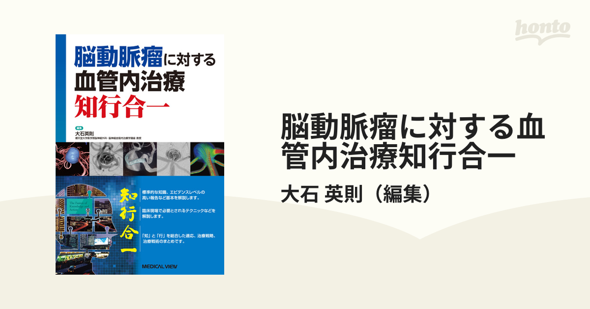 脳動脈瘤に対する血管内治療知行合一