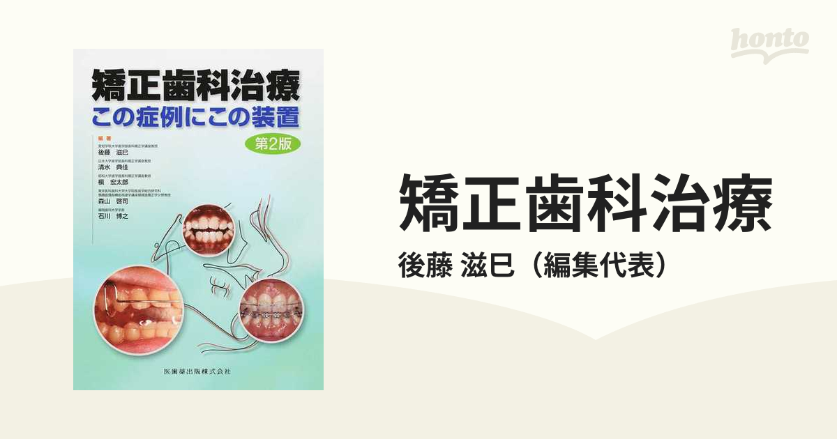 矯正歯科治療この症例にこの装置