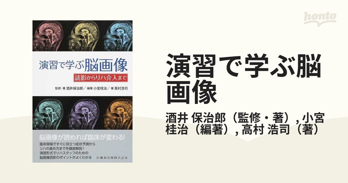 演習で学ぶ脳画像 読影からリハ介入まで