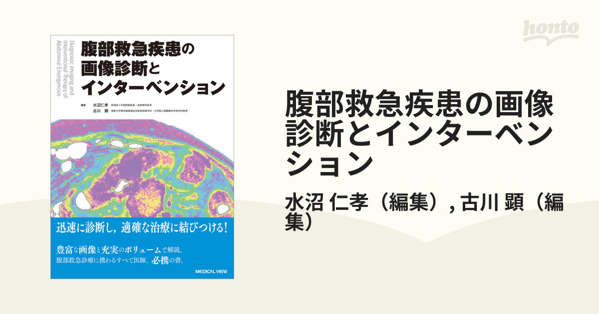 腹部救急疾患の画像診断とインターベンション