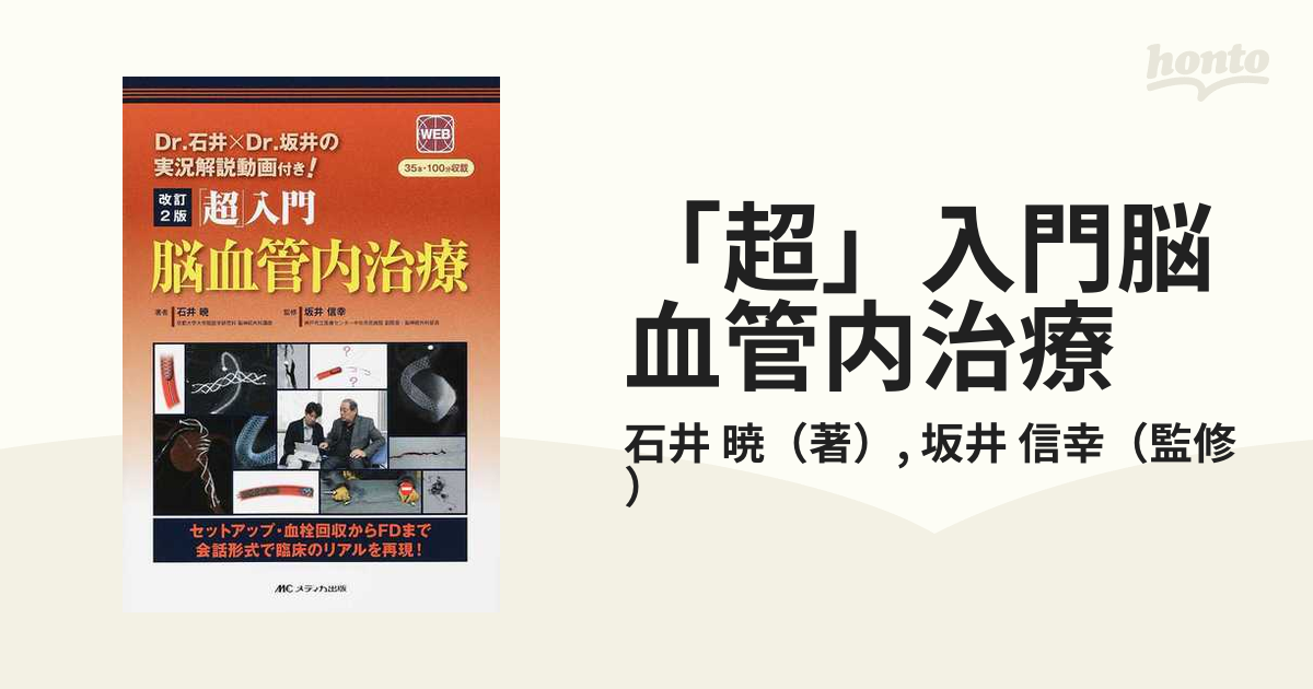 超」入門脳血管内治療 セットアップ・血栓回収からＦＤまで会話形式で 