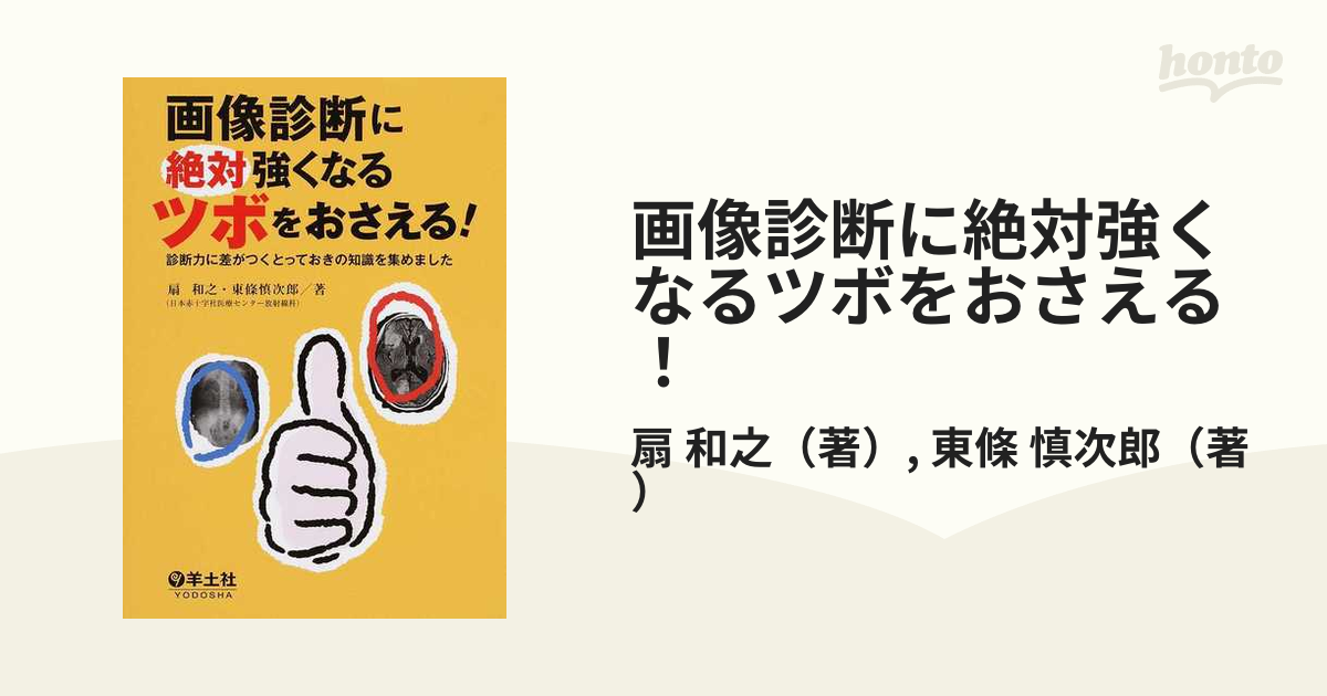 限定特価】【限定特価】画像診断に絶対強くなるツボをおさえる! 診断力