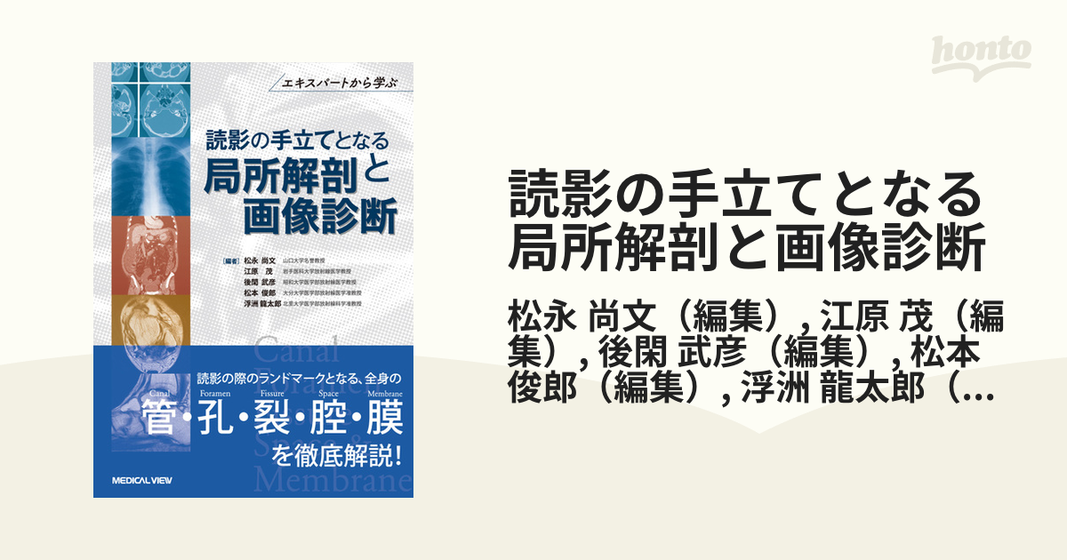 読影の手立てとなる局所解剖と画像診断 エキスパートから学ぶ