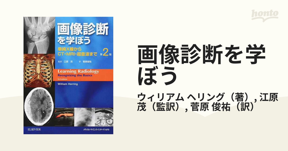 販売正本 画像診断を学ぼう : 単純X線写真とCTの基本