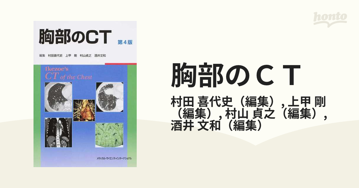 胸部のＣＴ 第４版