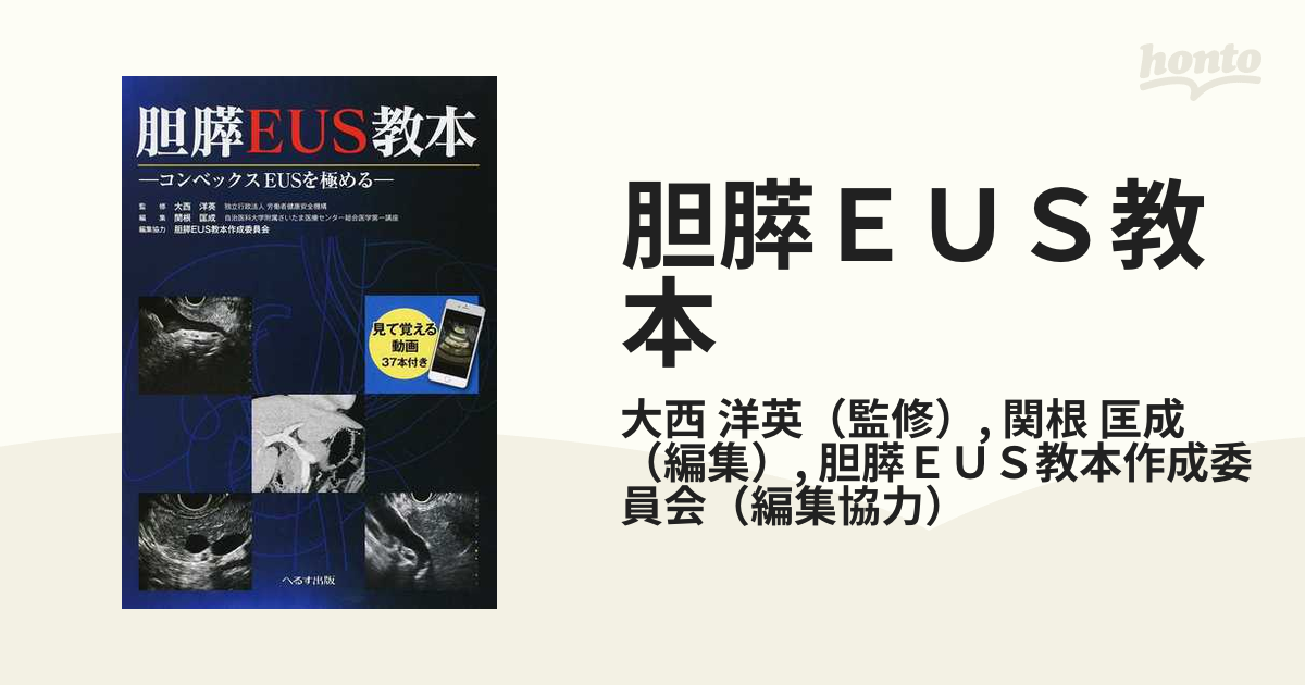 胆膵EUS教本?コンベックスEUSを極める - 臨床医学