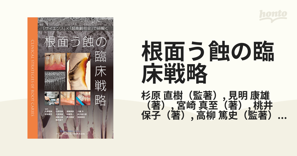 根面う蝕の臨床戦略 「サイエンス」×「超高齢社会」で紐解くの通販