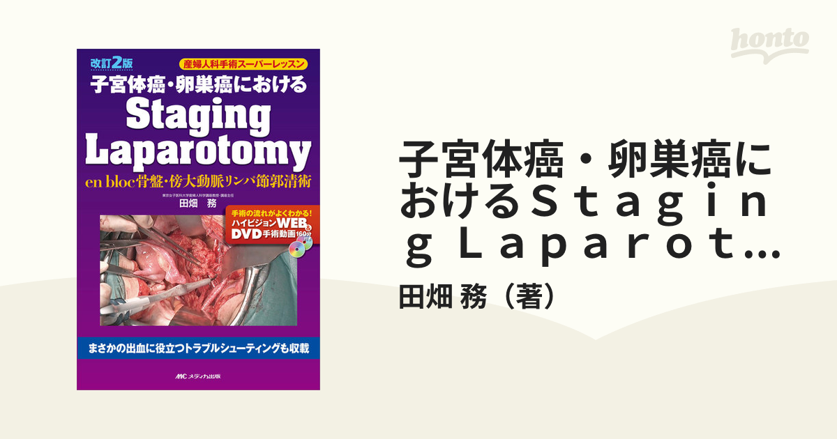 子宮体癌・卵巣癌におけるStaging Laparotomy - 雑誌