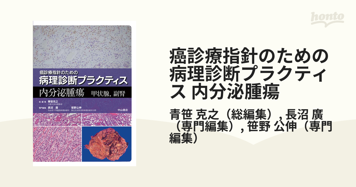 買いファッション 内分泌腫瘍 甲状腺 副腎[本/雑誌] (癌診療指針のため