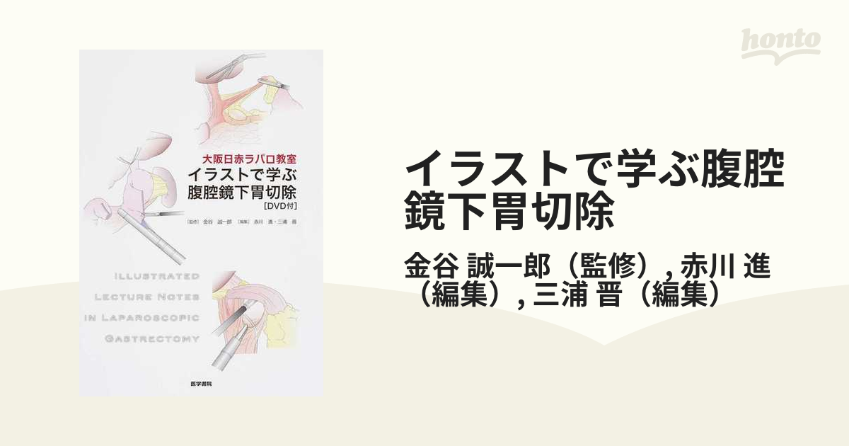 イラストで学ぶ腹腔鏡下胃切除 大阪日赤ラパロ教室の通販/金谷 誠一郎