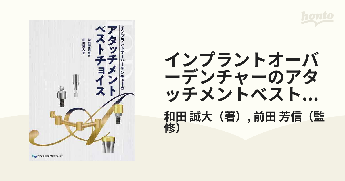 春夏新作 インプラントオーバーデンチャーのアタッチメントベスト