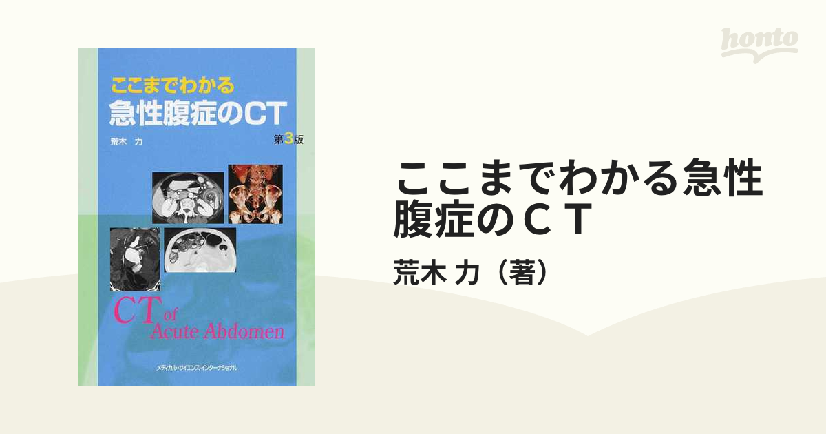 ここまでわかる急性腹症のＣＴ 第３版の通販/荒木 力 - 紙の本：honto