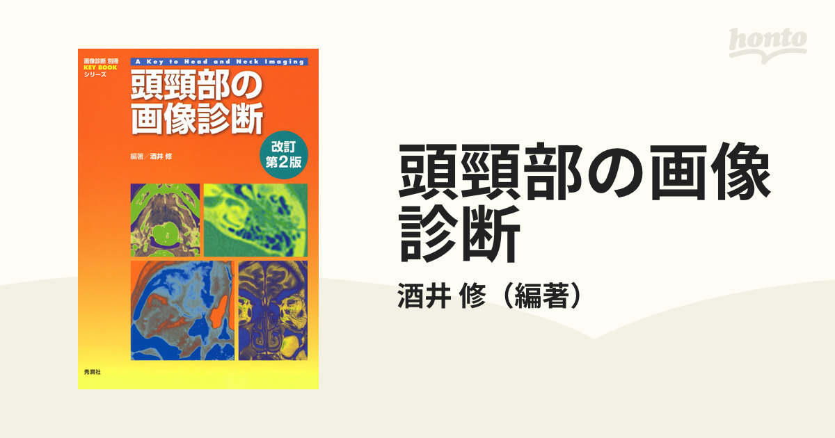 頭頸部の画像診断 改訂第２版の通販/酒井 修 - 紙の本：honto本の通販