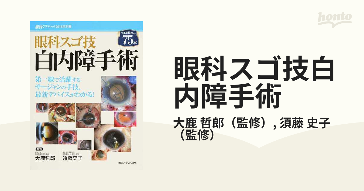 眼科スゴ技白内障手術 第一線で活躍するサージャンの手技，最新デバイスがわかる！