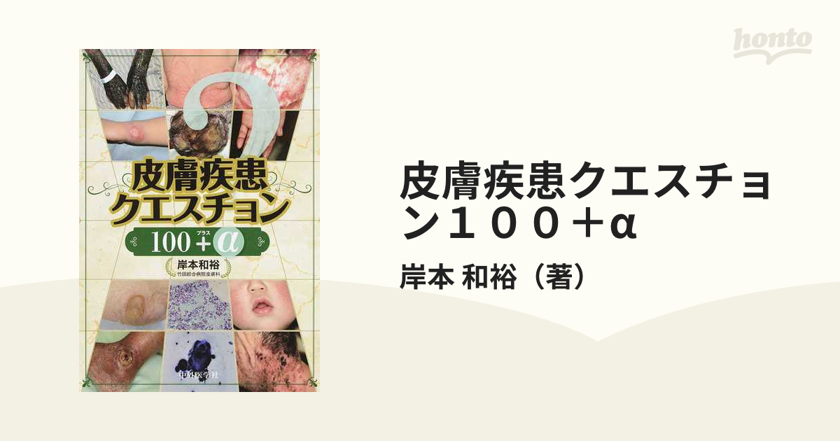 皮膚疾患クエスチョン100プラスα 裁断済み 史上最も激安 - 健康・医学