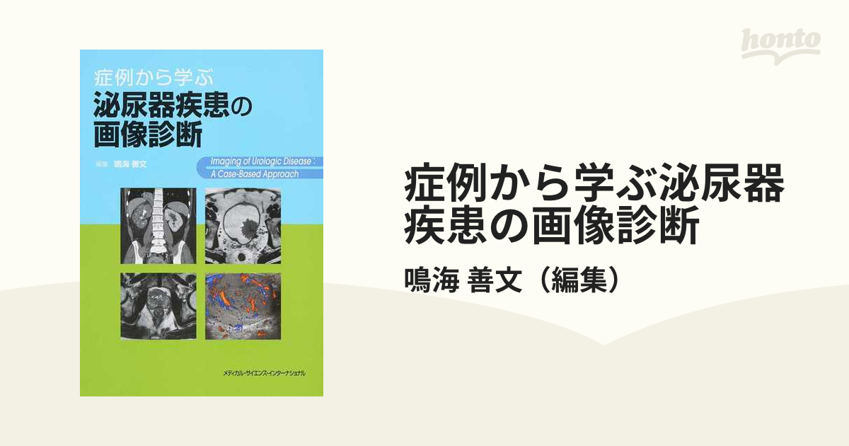 日本限定 裁断済 症例から学ぶ泌尿器疾患の画像診断 健康/医学 