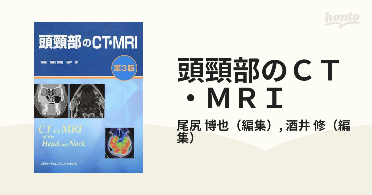 頭頸部のＣＴ・ＭＲＩ 第３版