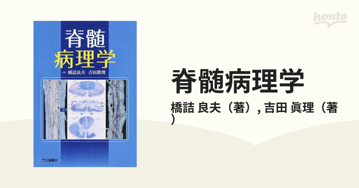脊髄病理学 aljaser.com.bh