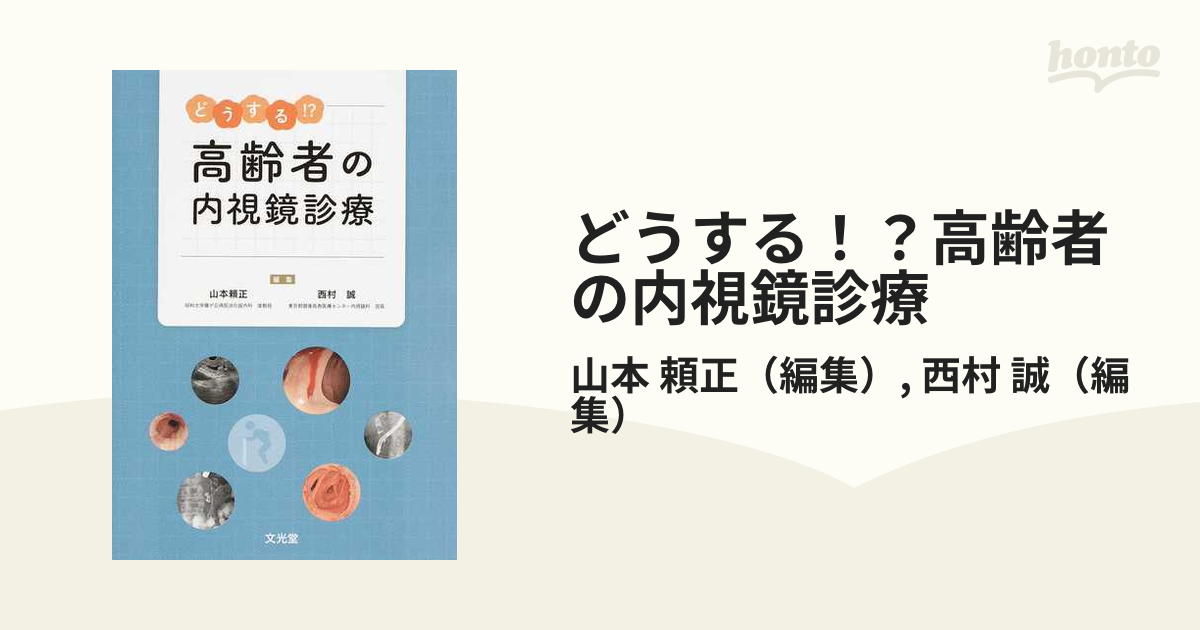 どうする！？高齢者の内視鏡診療