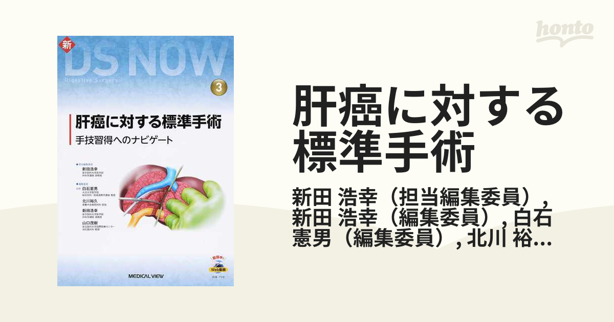 肝癌に対する標準手術―手技習得へのナビゲート - その他