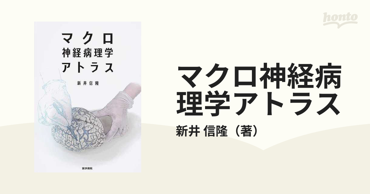 マクロ神経病理学アトラスの通販/新井 信隆 - 紙の本：honto本の通販ストア