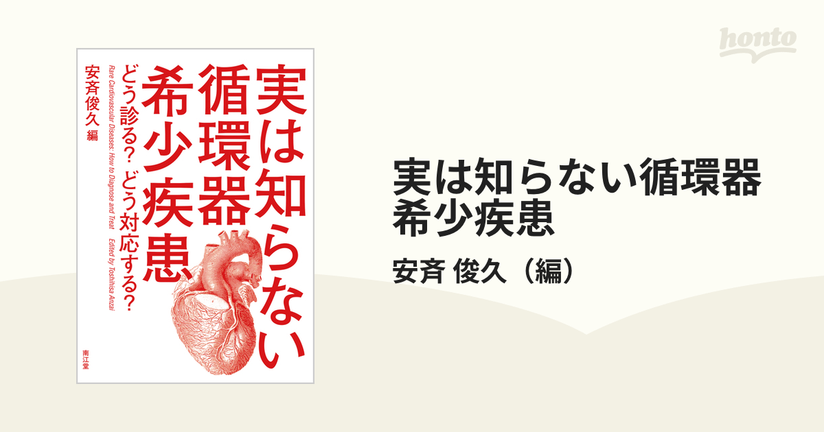 実は知らない循環器希少疾患 どう診る?どう対応する?-connectedremag.com