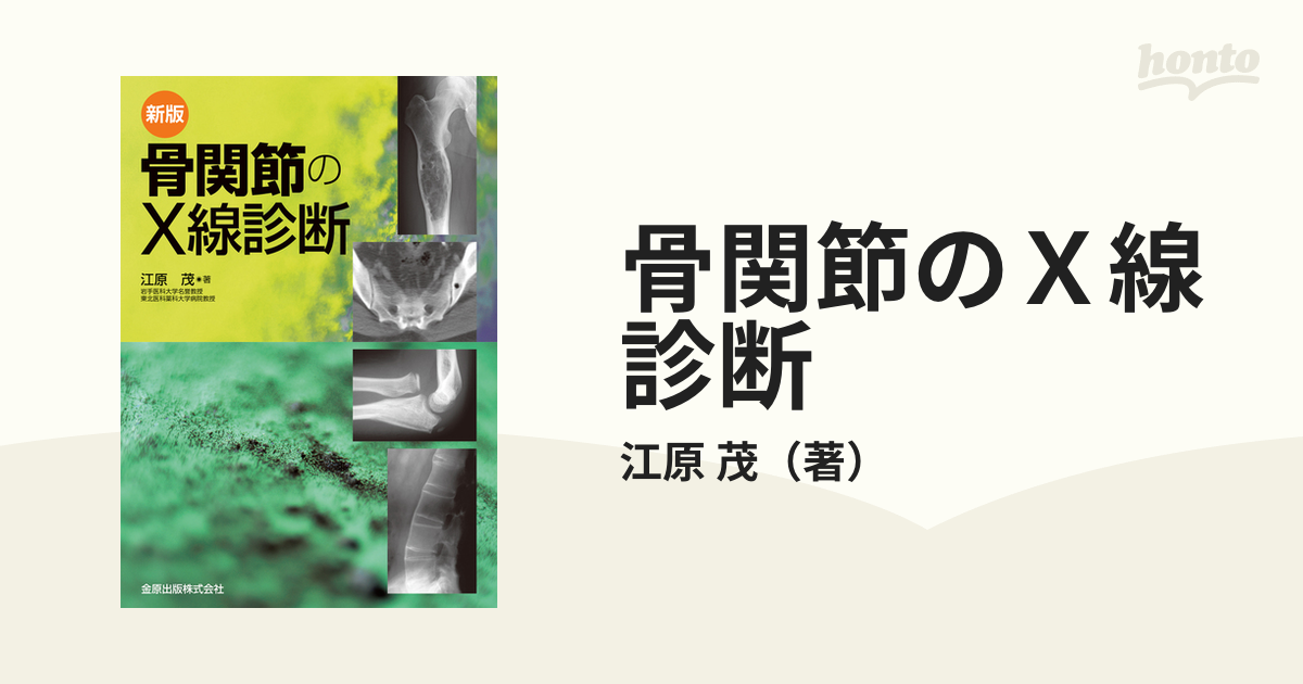 新版 骨関節のX線診断 - 語学/参考書