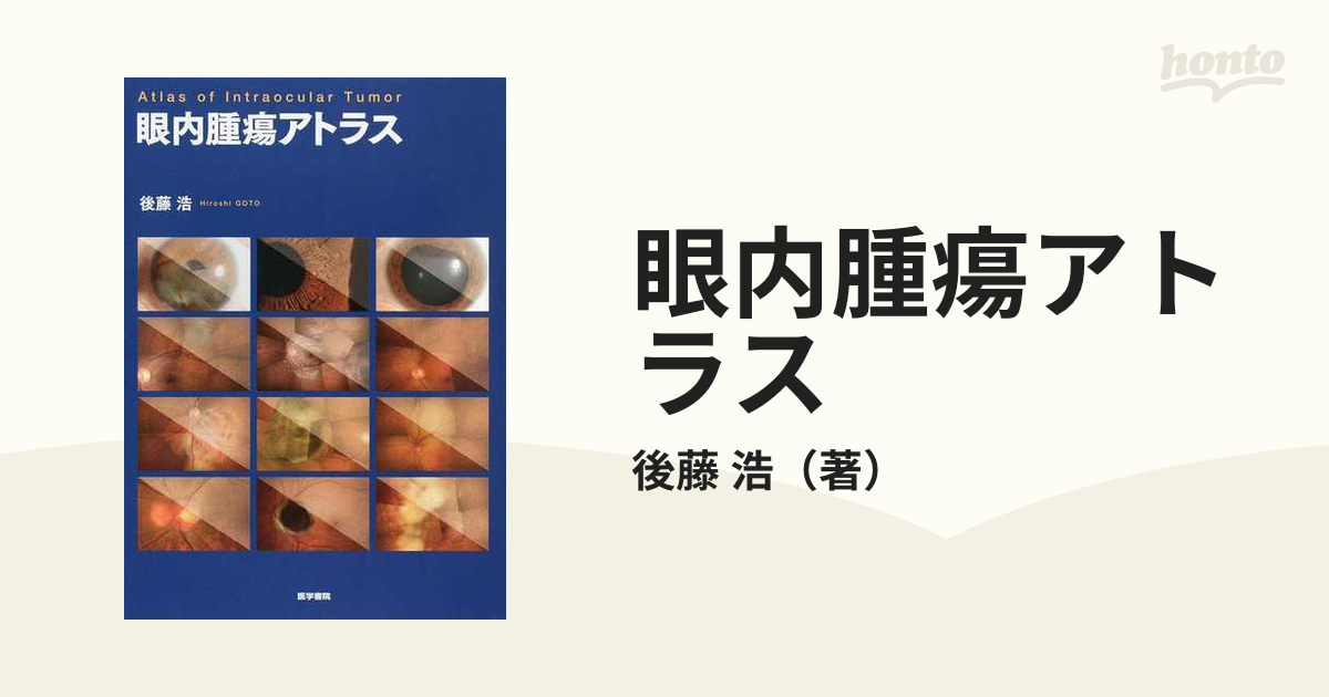 激安通販新作 眼内腫瘍アトラス 新品 asakusa.sub.jp