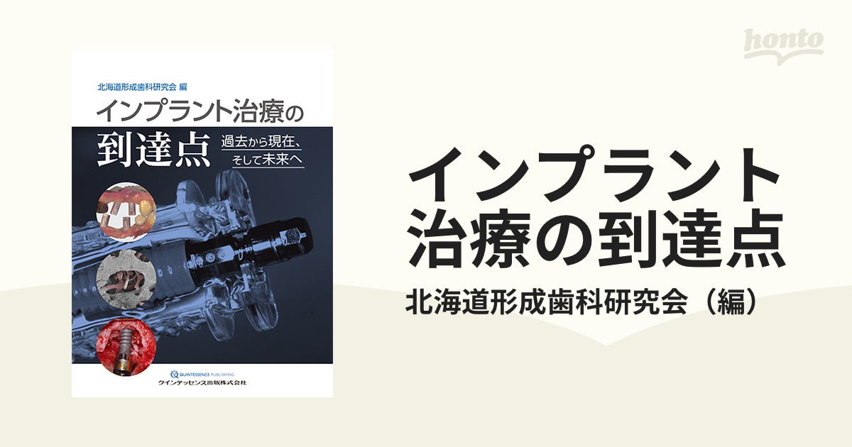 インプラント治療の到達点 過去から現在、そして未来へ-