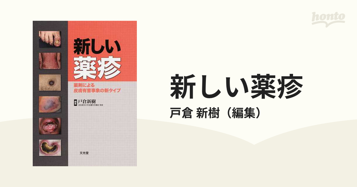 新しい薬疹 薬剤による皮膚有害事象の新タイプ