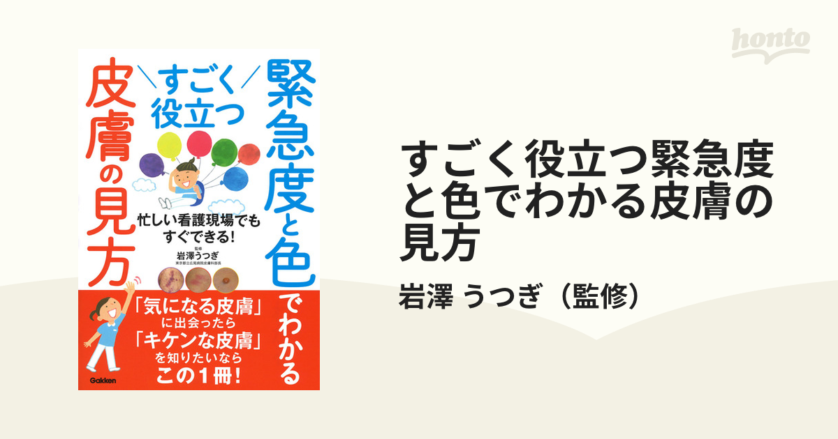 すごく役立つ緊急度と色でわかる皮膚の見方 忙しい看護現場でもすぐできる！