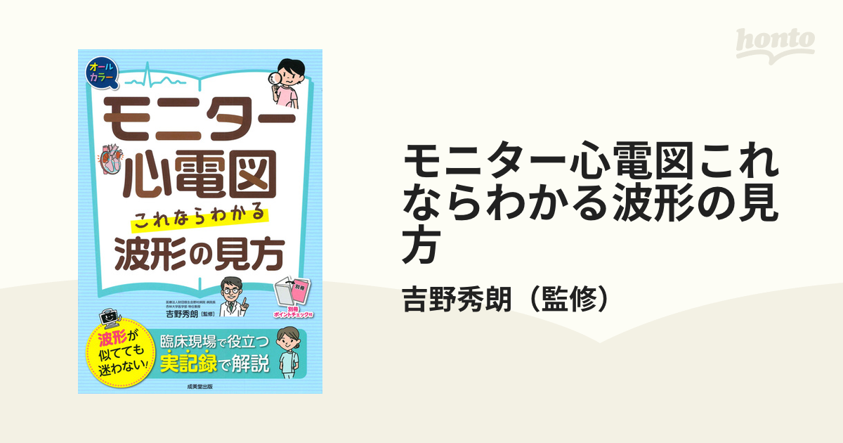 モニター心電図これならわかる波形の見方