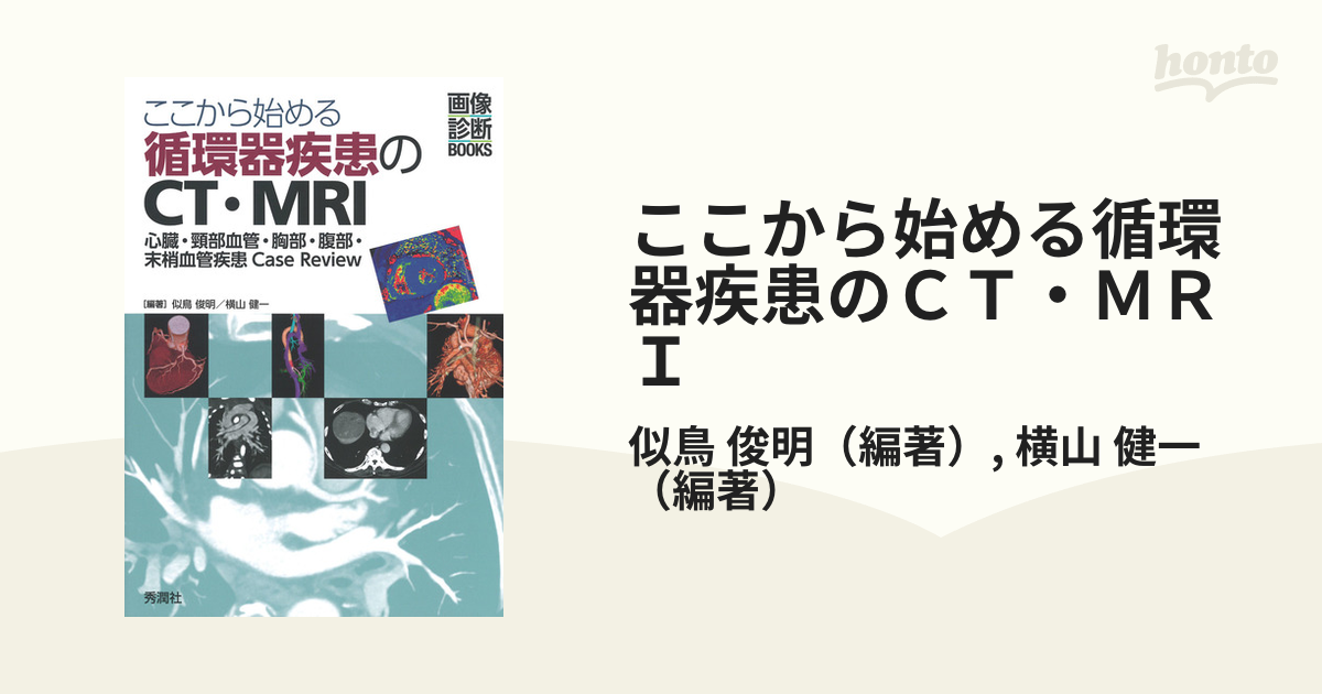 ここから始める循環器疾患のＣＴ・ＭＲＩ　心臓・頸部血管・胸部・腹部・末梢血管疾患Ｃａｓｅ　健一　Ｒｅｖｉｅｗの通販/似鳥　俊明/横山　紙の本：honto本の通販ストア