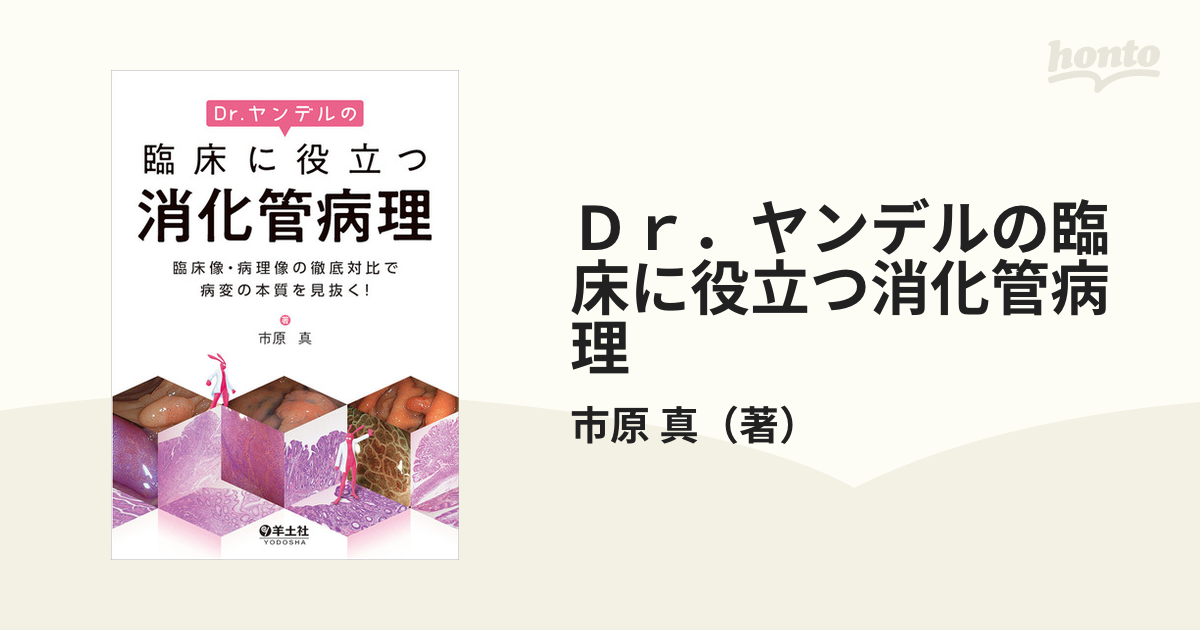 Drヤンデルの臨床に役立つ消化管病理-connectedremag.com