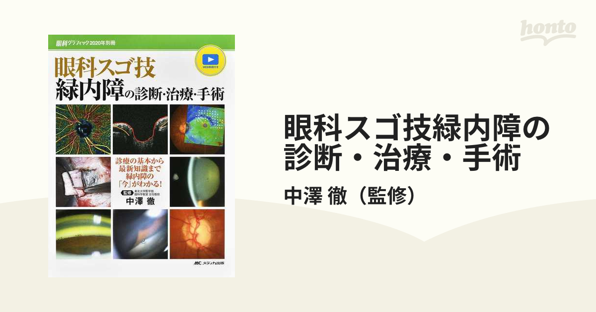 眼科スゴ技緑内障の診断・治療・手術 診療の基本から最新知識まで緑内障の「今」がわかる！