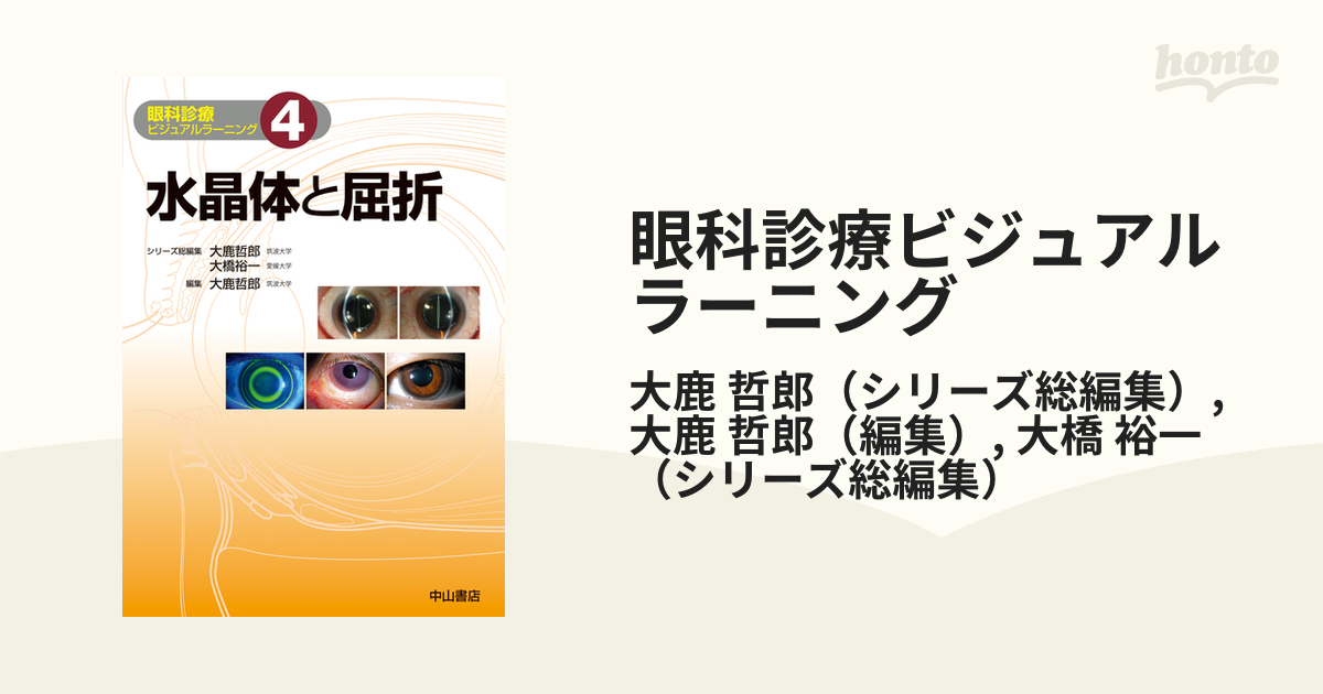 ビンディングの販売 眼科診療ビジュアルラーニング 4【1000円以上送料