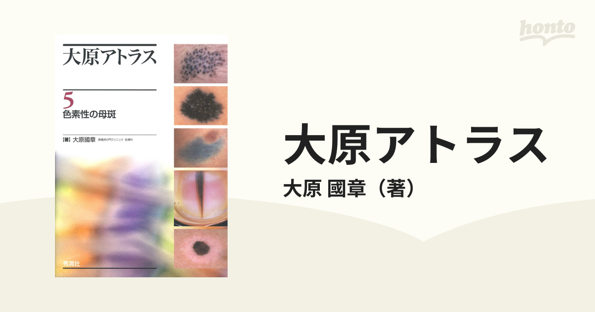 SALE／94%OFF】 皮膚科大原アトラス5色素性の母斑 大原アトラス