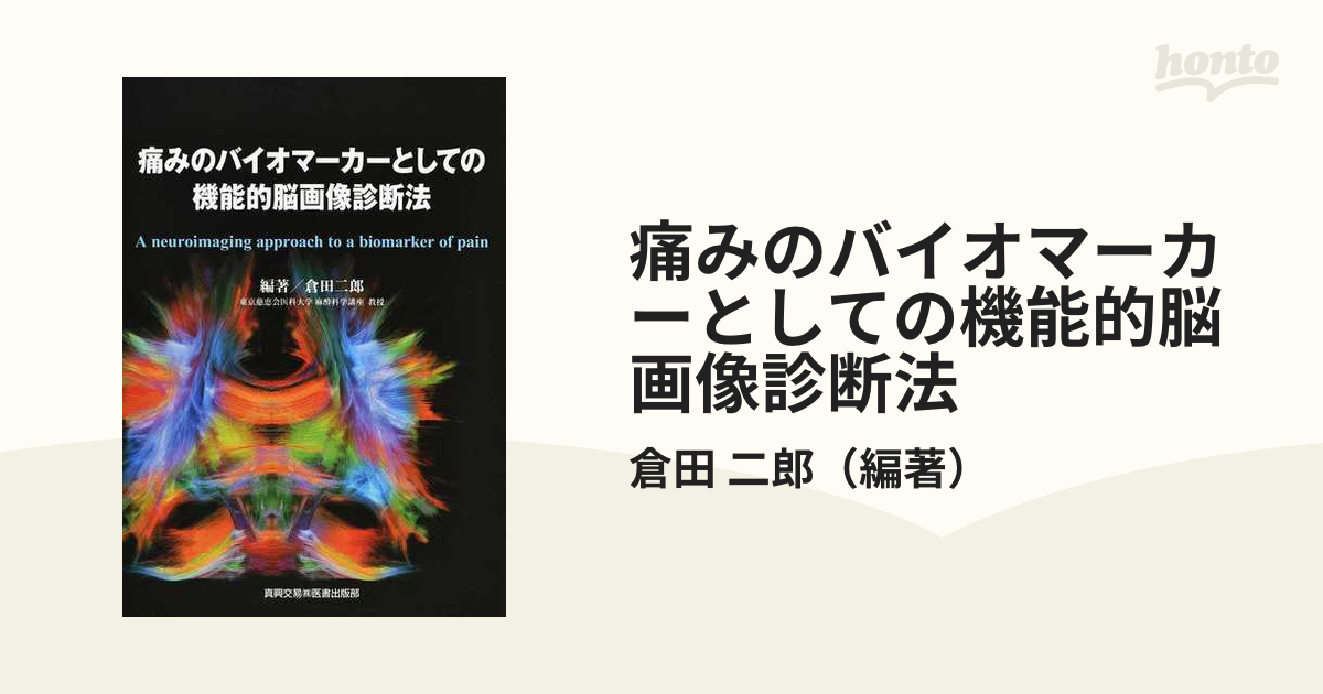 痛みのバイオマーカーとしての機能的脳画像診断法