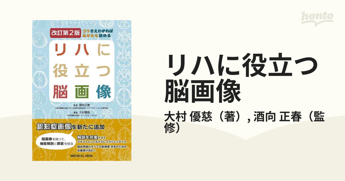 リハに役立つ脳画像 コツさえわかればあなたも読める 改訂第２版