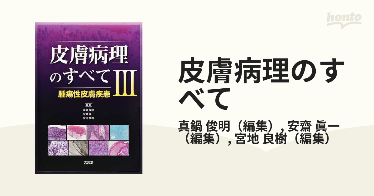 皮膚病理のすべて 3 腫瘍性皮膚疾患