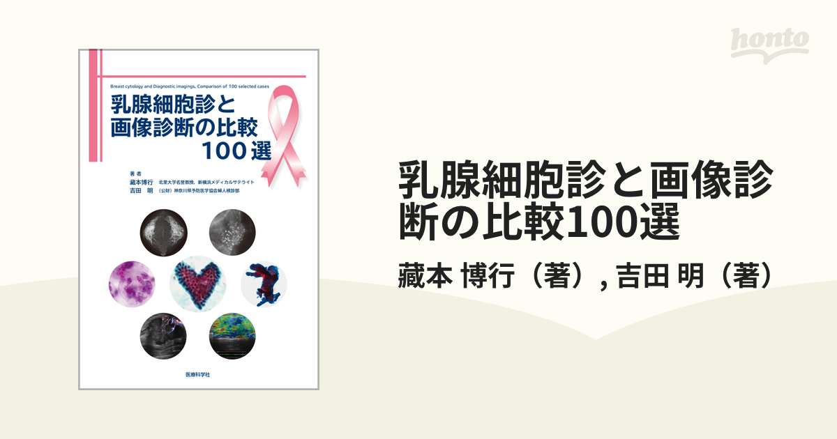 乳腺細胞診と画像診断の比較100選の通販/藏本　明　博行/吉田　紙の本：honto本の通販ストア