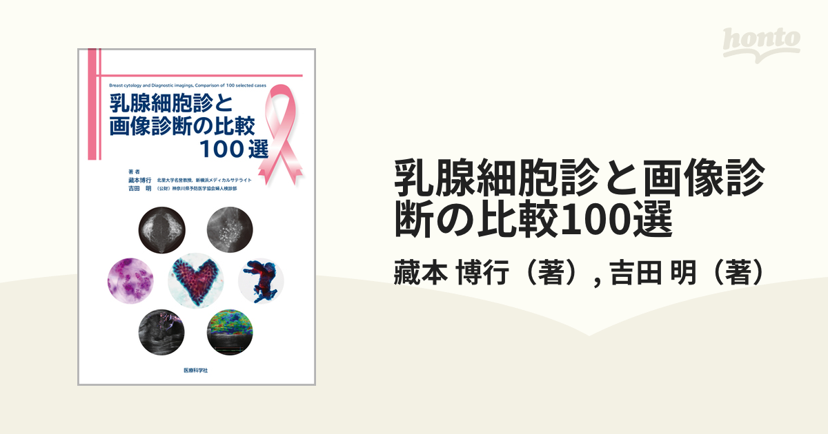 乳腺細胞診と画像診断の比較100選