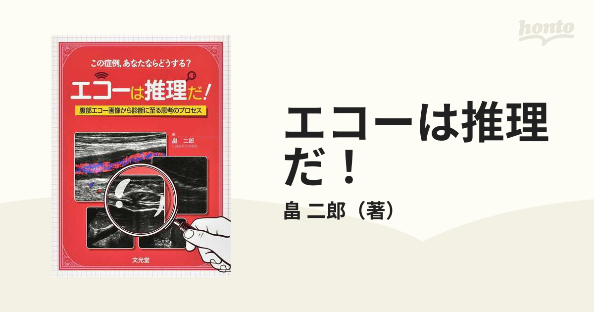 エコーは推理だ 腹部エコー画像から診断に至る思考のプロセス