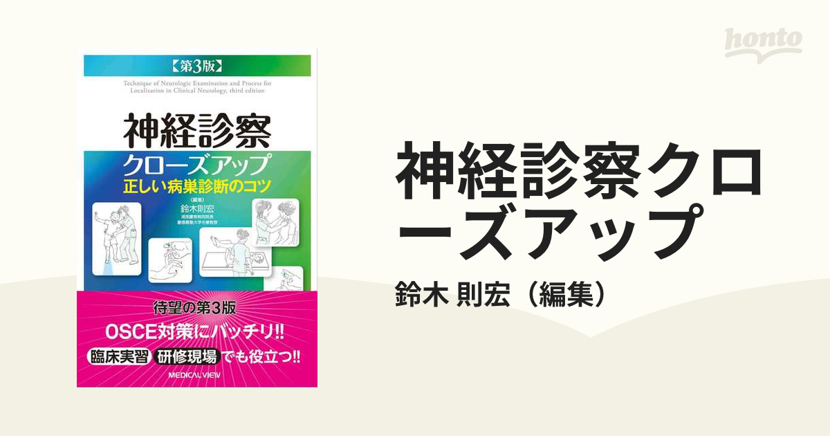 人気新品入荷 神経診察クローズアップ 正しい病巣診断のコツ