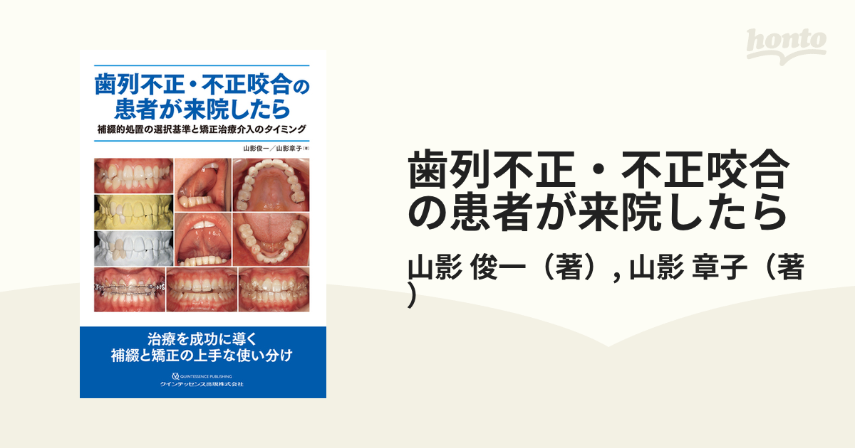 歯列不正・不正咬合の患者が来院したら 補綴的処置の選択基準と矯正治療介入のタイミング