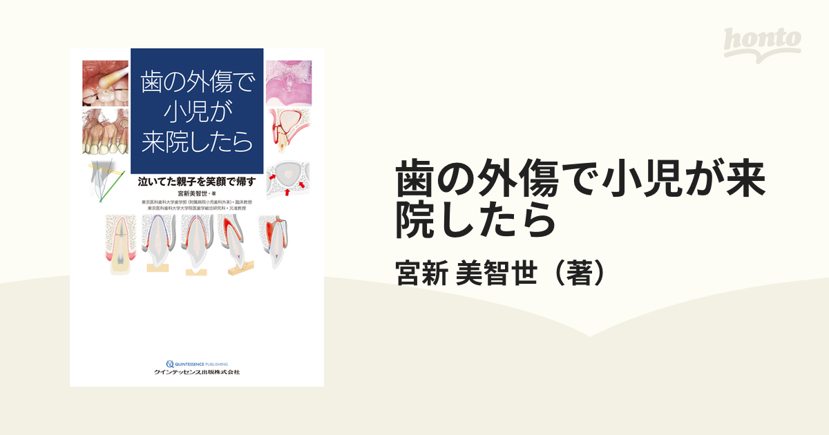 歯の外傷で小児が来院したら 泣いてた親子を笑顔で帰すの通販/宮新