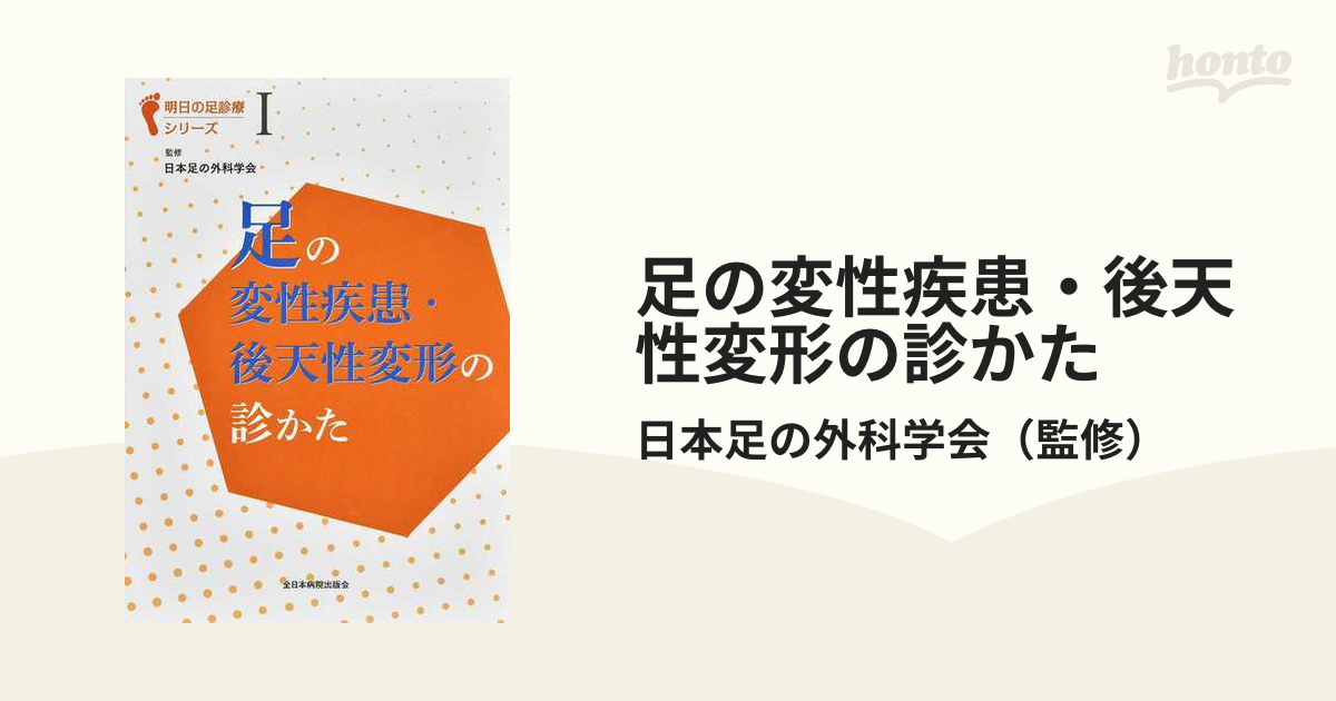 足の変性疾患・後天性変形の診かた