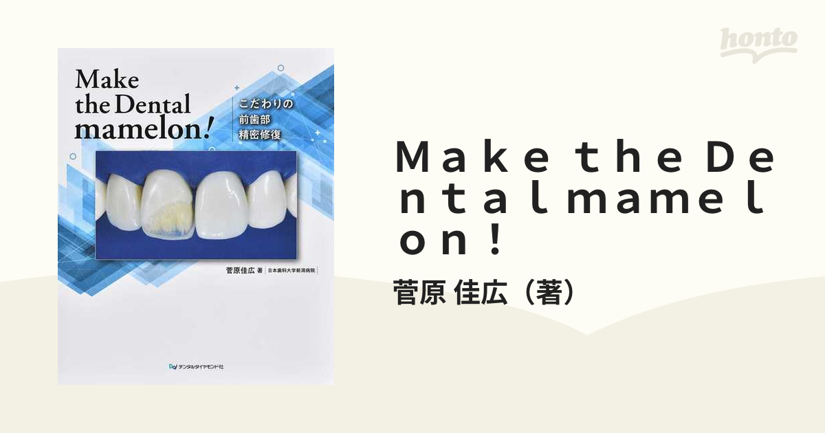 Make the Dental mamelon こだわりの前歯部精密修復