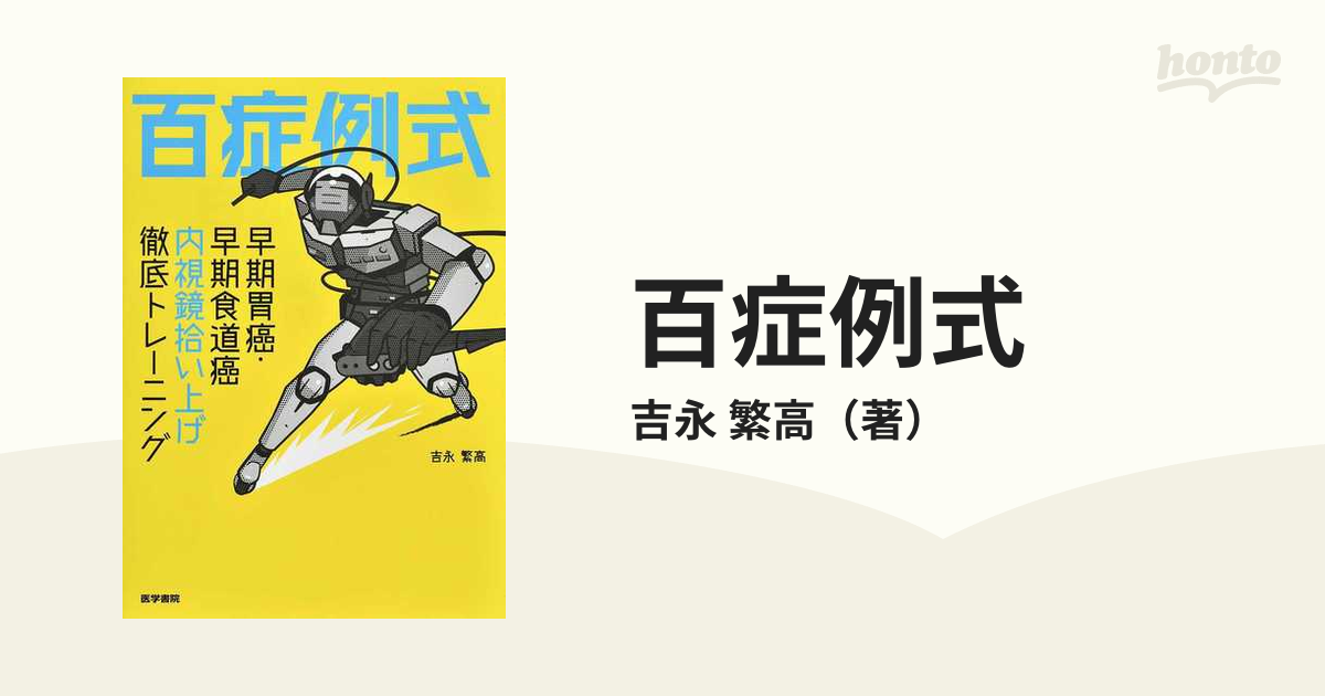 百症例式 早期胃癌・早期食道癌 内視鏡拾い上げ徹底トレーニング