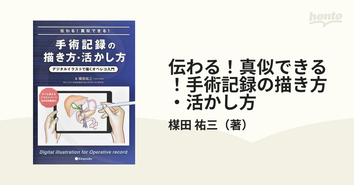 伝わる！真似できる！手術記録の描き方・活かし方 デジタルイラストで描くオペレコ入門